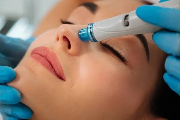 Hydra facial treatment